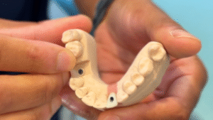 Michael Rowland holding a teeth model to demonstrate dental implants at North Down Dental in Bangor, Northern Ireland.