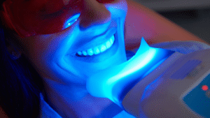 North Down Dental Bangor Northern Ireland, using Teeth Whitening products. 
