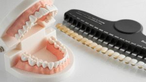 Teeth model and shade guide for teeth whitening at North Down Dental Northern Ireland, Bangor