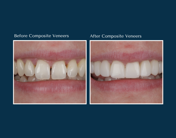 Blog - North Down Dental